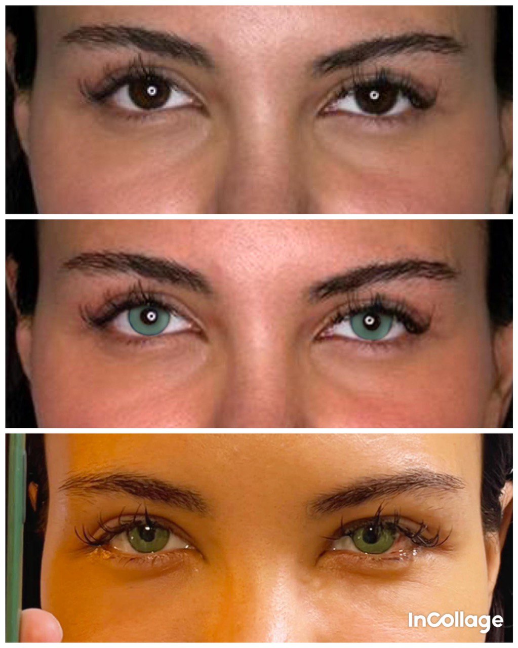 FLAAK əməliyyatının riskləri