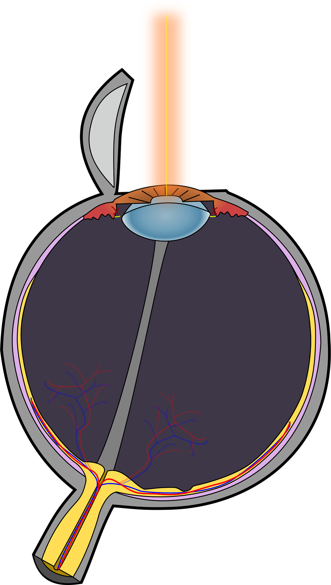 LASIK əməliyyatı nədir? Kimlər üçün uyğundur?